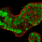 Anti-Nucleolin antibody [364-5] used in Immunocytochemistry/ Immunofluorescence (ICC/IF). GTX34916