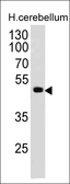 Anti-PAX6 antibody [PAX6/498] used in Western Blot (WB). GTX34955