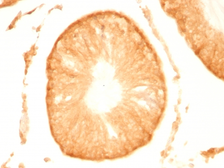 Anti-PGP9.5 antibody [UCHL1/775] used in IHC (Paraffin sections) (IHC-P). GTX34971