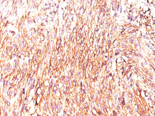 Anti-TMEM16A antibody [DOG-1.1] used in IHC (Paraffin sections) (IHC-P). GTX35127