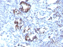 Anti-Transgelin antibody [SPM606] used in IHC (Paraffin sections) (IHC-P). GTX35142