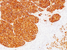 Anti-Tyrosinase antibody [SPM360] used in IHC (Paraffin sections) (IHC-P). GTX35152