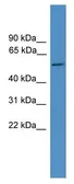 Anti-TTYH3 antibody used in Western Blot (WB). GTX35188