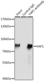 Anti-YAP1 antibody used in Immunoprecipitation (IP). GTX35195