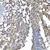 Anti-CSK antibody used in IHC (Paraffin sections) (IHC-P). GTX35201