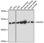 Anti-NDUFS2 antibody used in Western Blot (WB). GTX35213