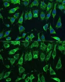 Anti-Galectin 3 antibody used in Immunocytochemistry/ Immunofluorescence (ICC/IF). GTX35218