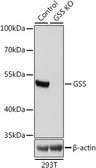 Anti-GSS antibody used in Western Blot (WB). GTX35220