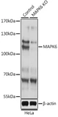 Anti-ERK3 antibody used in Western Blot (WB). GTX35227