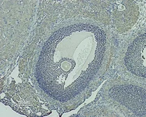 Anti-GnRHR antibody used in IHC (Paraffin sections) (IHC-P). GTX35245