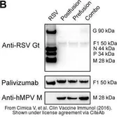 Anti-Human metapneumovirus matrix antibody [4821] used in Western Blot (WB). GTX36792