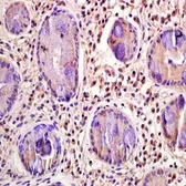 Anti-CD33 antibody used in IHC (Paraffin sections) (IHC-P). GTX37451