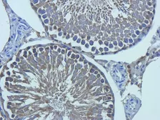 Anti-TGF beta Receptor 2 antibody used in IHC (Paraffin sections) (IHC-P). GTX37527