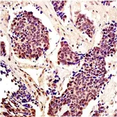 Anti-STAT5 antibody used in IHC (Paraffin sections) (IHC-P). GTX37534