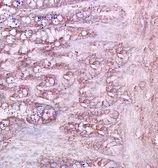Anti-CD79a antibody used in IHC (Paraffin sections) (IHC-P). GTX37553