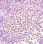 Anti-SP7 antibody used in IHC (Paraffin sections) (IHC-P). GTX37579