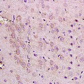 Anti-NMDAR2D antibody used in IHC (Paraffin sections) (IHC-P). GTX37591