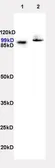 Anti-NCX3 antibody used in Western Blot (WB). GTX37608