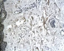 Anti-Collagen VII antibody used in IHC (Paraffin sections) (IHC-P). GTX37733