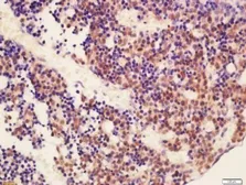 Anti-RUNX2 antibody used in IHC (Paraffin sections) (IHC-P). GTX37759