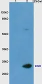 Anti-Casein antibody used in Western Blot (WB). GTX37769