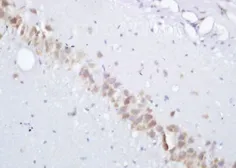 Anti-gamma Adaptin antibody used in IHC (Paraffin sections) (IHC-P). GTX37788