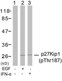 Anti-p27 Kip1 (phospho Thr187) antibody used in Western Blot (WB). GTX38594