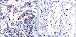 Anti-c-Jun (phospho Ser73) antibody used in IHC (Paraffin sections) (IHC-P). GTX38608