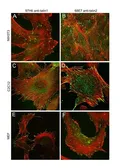 Anti-Talin-1 antibody [97H6] used in Immunocytochemistry/ Immunofluorescence (ICC/IF). GTX38972