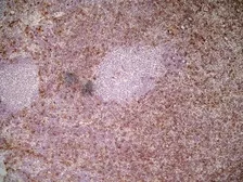 Anti-Ly6c antibody [ER-MP20] used in IHC (Frozen sections) (IHC-Fr). GTX39790