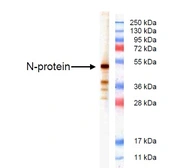 Anti-Infectious Bronchitis virus (IBV) Nucleoprotein antibody [B819M] used in Western Blot (WB). GTX41333