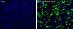 Anti-Hepatitis B virus Surface Antigen antibody [S 26] used in Immunocytochemistry/ Immunofluorescence (ICC/IF). GTX41800