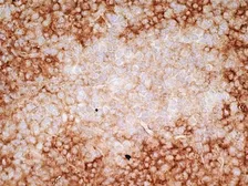 Anti-CD36 antibody [SMØ] used in IHC (Frozen sections) (IHC-Fr). GTX42050