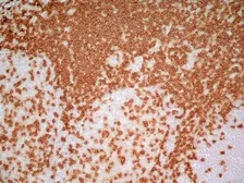 Anti-CD3 epsilon antibody [UCHT1] (Low endotoxin, azide free) used in IHC (Frozen sections) (IHC-Fr). GTX42102