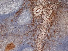 Anti-Mannose Receptor antibody [7-450] used in IHC (Frozen sections) (IHC-Fr). GTX42266