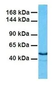 Anti-ARX antibody, Internal used in Western Blot (WB). GTX44640