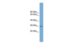Anti-BarX2 antibody, N-term used in Western Blot (WB). GTX44650