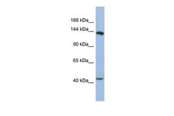 Anti-SLIT1 antibody, Internal used in Western Blot (WB). GTX44819