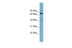 Anti-LRDD antibody, N-term used in Western Blot (WB). GTX44938