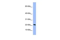 Anti-PIN4 antibody, Internal used in Western Blot (WB). GTX45041
