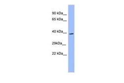 Anti-SH3GL2 antibody, N-term used in Western Blot (WB). GTX45053