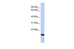 Anti-ARL17 antibody, Internal used in Western Blot (WB). GTX45082