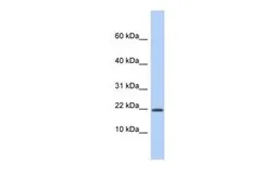 Anti-HCFC1R1 antibody, Internal used in Western Blot (WB). GTX45103