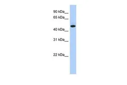 Anti-C5ORF36 antibody, N-term used in Western Blot (WB). GTX45226