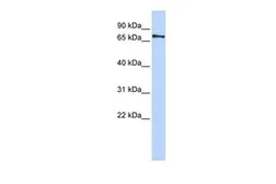 Anti-PHACTR1 antibody, Internal used in Western Blot (WB). GTX45287