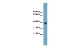 Anti-NUDCD3 antibody, Internal used in Western Blot (WB). GTX45313