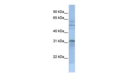 Anti-MTCH2 antibody, N-term used in Western Blot (WB). GTX45343