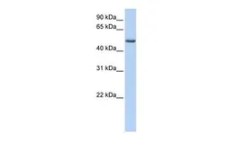 Anti-PHLDA1 antibody, C-term used in Western Blot (WB). GTX45377