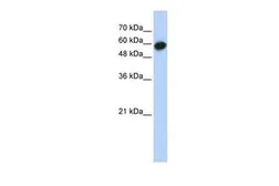 Anti-LRRC6 antibody, Internal used in Western Blot (WB). GTX45478