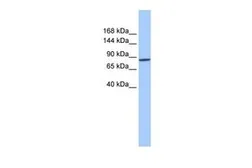 Anti-AP2B1 antibody, Internal used in Western Blot (WB). GTX45496